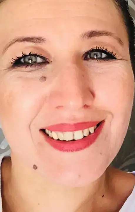 34 Kiloya Düşmüştü, Antalya'daki Operasyonla Hayata Döndü 3